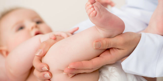 در رفتگی مادرزادی لگن در ناحیه مفصل ران بچه ها(علت، علائم و درمان)