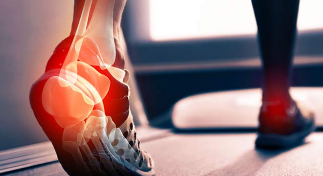 تاندنیت آشیل چیست. درد پشت پاشنه پا به چه علت ایجاد میشود