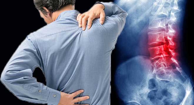 چگونه درست سر پا بایستیم تا دچار کمردرد نشویم. پیشگیری از کمردرد