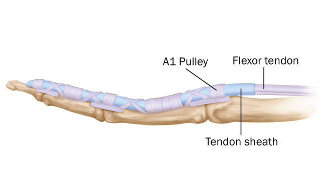تاندون انگشت دست