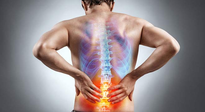 اسپوندیلولیز مهره کمری چیست و چگونه درمان میشود
