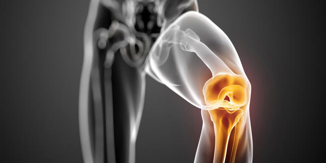 محدودیت و خشکی حرکت مفصل زانو بعد از شکستگی استخوان ران