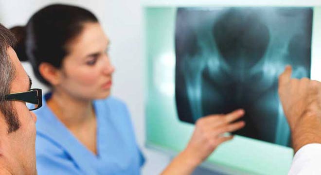 تشخیص شکستگی استخوان - رادیوگرافی و تصویربرداری