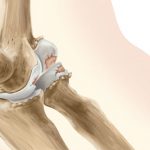 ساییدگی و آرتروز آرنج