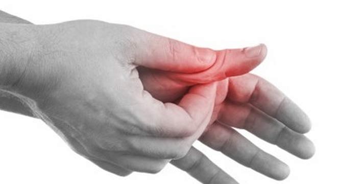 رباط های انگشت دست چگونه آسیب میبینند. علائم و درمان