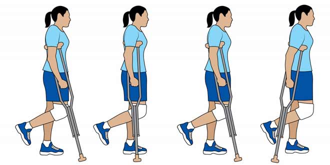 روش درست حرکت کردن و راه رفتن بعد از درمان شکستگی یا عمل جراحی پا چیست
