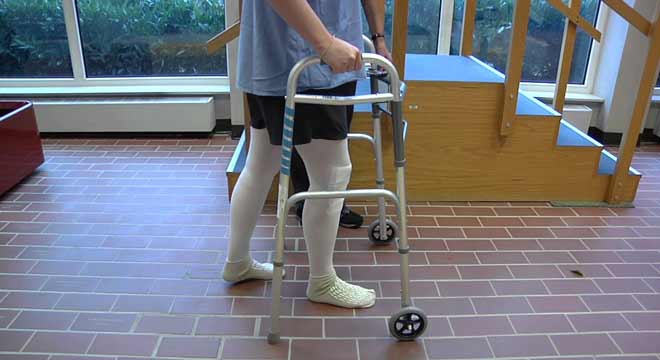 راه رفتن و استفاده از پله پس از تعویض مفصل زانو به چه صورت است