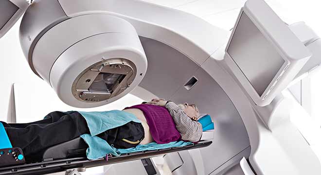رادیوتراپی چگونه در درمان سرطان استفاده میشود