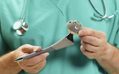 تعویض مفصل ران در ناحیه لگن بدنبال ساییدگی و آرتروز شدید