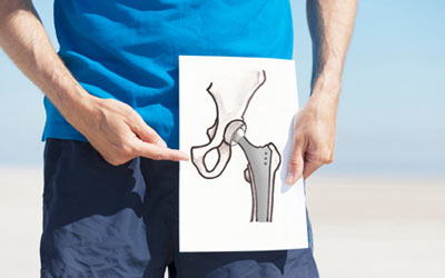 تعویض مفصل ران در ناحیه لگن در یک خانم جوان به علت عوارض ناشی از دررفتگی مفصل