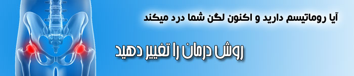 آیا روماتیسم دارید و اکنون لگن شما درد میکند. روش درمان را تغییر دهید