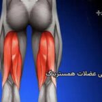 کشیدگی همسترینگ در پشت ران چگونه درمان میشود