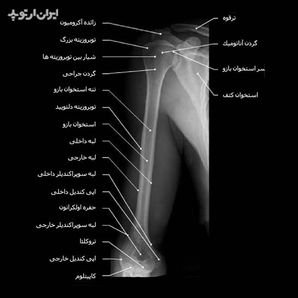 آناتومی جامع بازو. استخوان، عضلات و رادیولوژی 10 رادیوگرافی بازو
