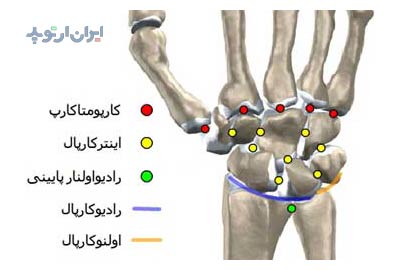 آناتومی جامع مچ دست 2 آناتومی مچ دست. مفاصل تشکیل دهنده