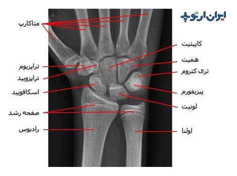 آناتومی جامع مچ دست 39 رادیوگرافی رخ مچ دست