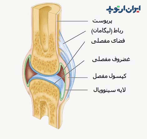 آرتروتومی چه نوع عمل جراحی است 2 ورم مفصل