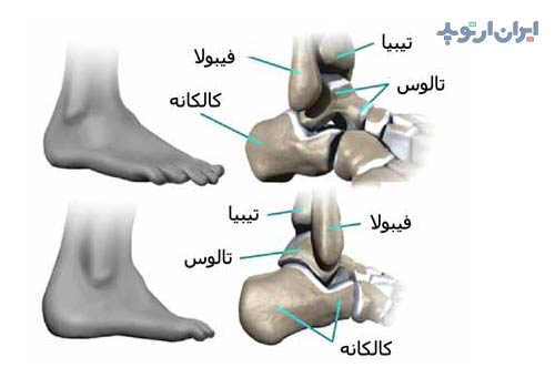آناتومی مچ پا 2 استخوان های مچ پا