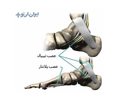 آناتومی مچ پا 26 آناتومی مچ پا. اعصاب