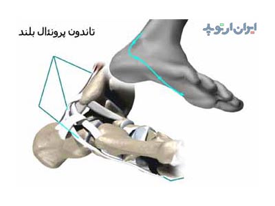 آناتومی مچ پا 18 آناتومی مچ پا. تاندون های مچ پا