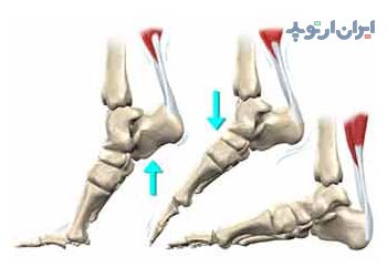 آناتومی مچ پا 13 آناتومی مچ پا. تاندون های مچ پا