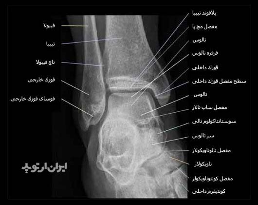آناتومی مچ پا 32 رادیوگرافی رخ مچ پا