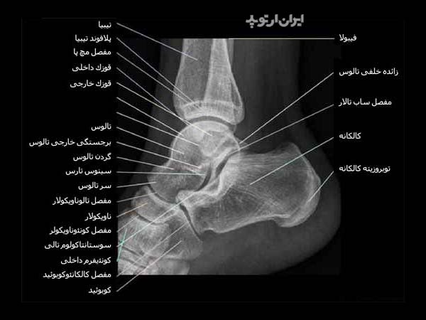 آناتومی مچ پا 31 رادیوگرافی نیمرخ مچ پا