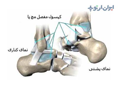 آناتومی مچ پا 10 آناتومی مچ پا. رباط های مچ پا