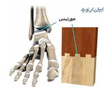 آناتومی مچ پا 3 آناتومی مچ پا
