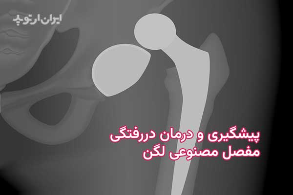 دررفتگی مفصل مصنوعی لگن 7 دررفتگی مفصل مصنوعی لگن