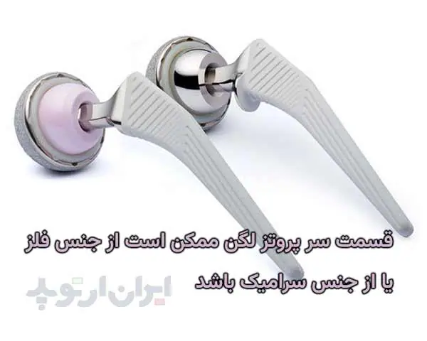 پروتز لگن چیست 4 قسمت سر پروتز لگن ممکن است از جنس فلز یا از جنس سرامیک باشد