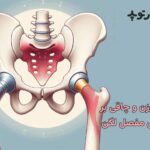 تاثیر وزن و چاقی بر تعویض مفصل لگن