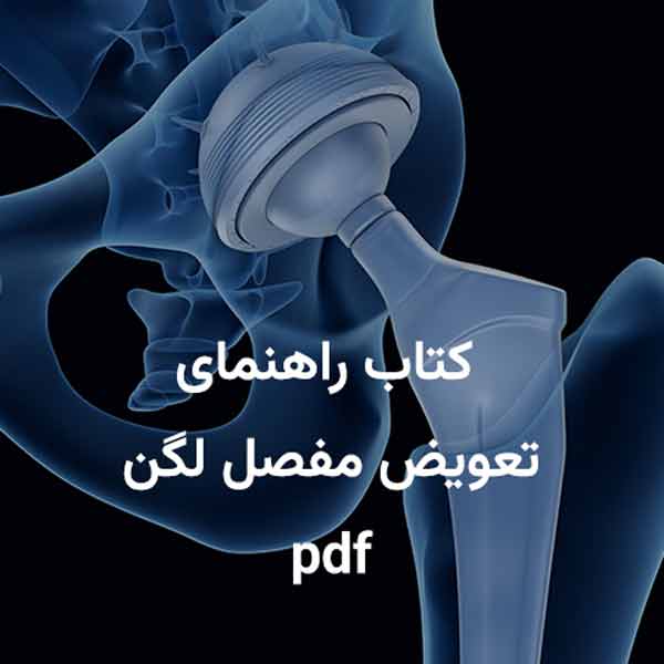 تعویض مفصل لگن بهترین راه درمان خرابی مفصل ران 27 راهنمای تعویض مفصل ران