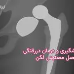 دررفتگی مفصل مصنوعی لگن