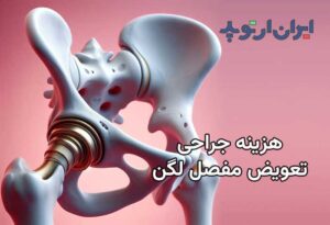 هزینه جراحی تعویض مفصل لگن