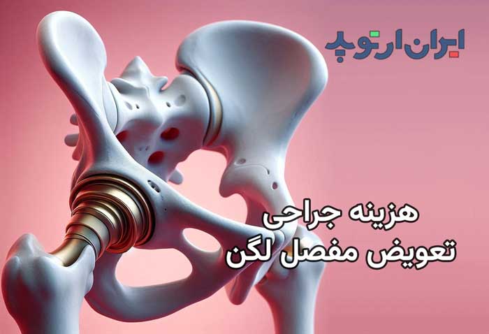 هزینه جراحی تعویض مفصل لگن