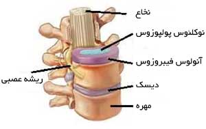 دیسک بین مهره ای