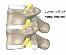 ریسه عصبی مهره کمر