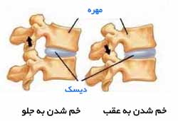 جسم مهره