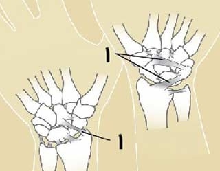 لیگامان های مچ دست