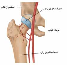  مسیر خونرسانی به سر استخوان ران