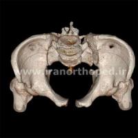 دررفتگی سمفیز پوبیس و مفصل ساکروایلیاک لگن