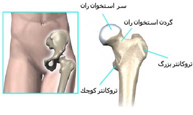 گردن استخوان ران و تروکانتر های بزرگ و کوچک