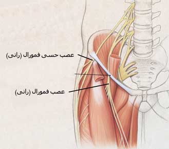 عصب فمورال یا رانی