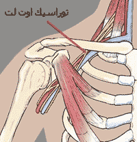 توراسیک اوتلت