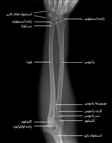رادیوگرافی رخ از استخوان های ساعد