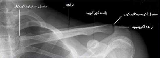 رادیوگرافی رخ ناحیه ترقوه