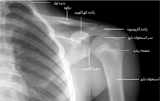 رادیوگرافی رخ شانه در سنین قبل از بلوغ