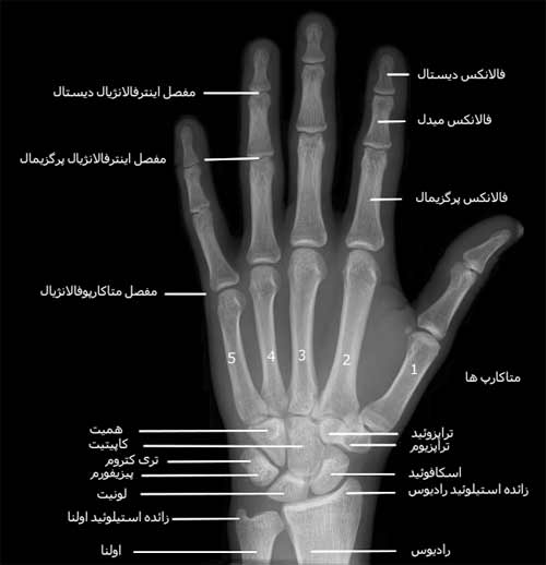 رادیوگرافی رخ دست