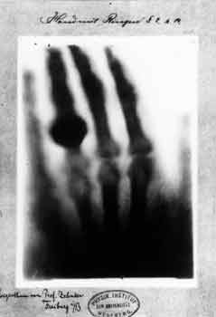  تصویر رادیوگرافی دست خانم رونتگن با حلقه