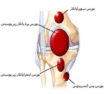 بورس های زانو